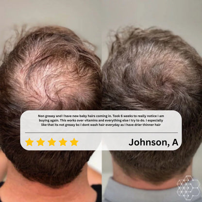 Hair Growth Roll-On Serum